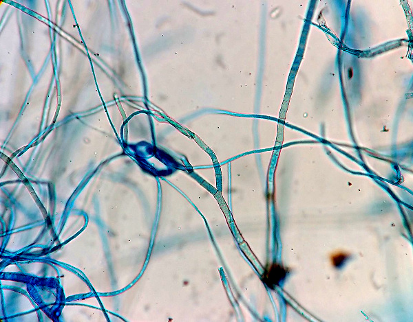 fungal hyphae, microscopic view; image courtesy of 'Microrao' and Wikimedia Commons