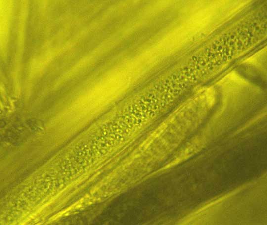 Cyanobacterium filament