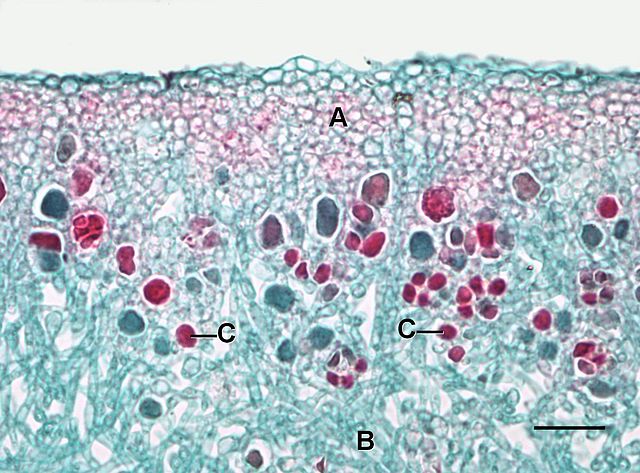 algal and fungal cells in Umbilicaria lichen; image courtesy of Jon Houseman, via Wikimedia Commons